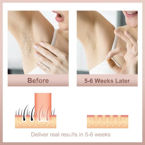 מכשיר להסרת שיער iBorria BR2022 בצבע לבן